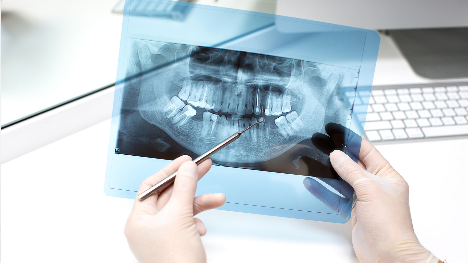 a dentist viewing 3D renderings showing the maxillary sinus membrane being lifted and bone graft material being added